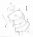 Fig. 07 - Infusion set improvements