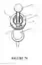 Fig. 08 - Drug delivery device