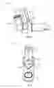 Fig. 07 - SPACER DEVICE WITH FLOW RATE SPIROMETER