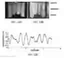 Fig. 09 - Methods, systems and computer program products for determining physiologic status parameters using signals derived from multispectral blood flow and perfusion imaging