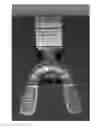 Fig. 01 - Orthodontic treatment