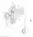 Fig. 02 - Electrical treatment of hydrocephalus