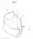 Fig. 02 - POWDER FOR SINTERING AND SINTERED BODY