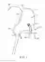 Fig. 08 - Head and neck rest