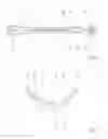Fig. 03 - Link rod for a motor vehicle