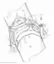 Fig. 02 - Pipe repair kit