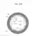 Fig. 22 - CONTACT LENS WITH IMPROVED, MULTIPLE AND INTEGRATED EFFECTS