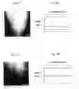 Fig. 02 - Antiglare Glass Sheet Article for Display Device and Method of Manufacturing Same