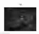 Fig. 01 - 3-D intraoral measurements using optical multiline method