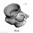 Fig. 08 - Hollow object model visualization in medical images