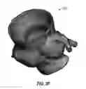 Fig. 09 - Hollow object model visualization in medical images