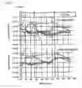 Fig. 06 - Plasmon generator with separating layer for thermal assisted magnetic recording head