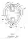 Fig. 02 - Wearable device with sound sealing structure