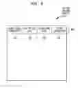 Fig. 07 - Outcome tracking in sensory prostheses