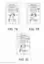 Fig. 08 - Binaural hearing assistance system comprising two wireless interfaces