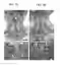 Fig. 02 - ORGAN REGENERATION METHOD UTILIZING BLASTOCYST COMPLEMENTATION
