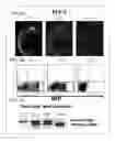 Fig. 03 - ORGAN REGENERATION METHOD UTILIZING BLASTOCYST COMPLEMENTATION
