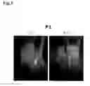 Fig. 04 - ORGAN REGENERATION METHOD UTILIZING BLASTOCYST COMPLEMENTATION