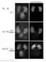 Fig. 06 - ORGAN REGENERATION METHOD UTILIZING BLASTOCYST COMPLEMENTATION