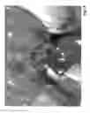 Fig. 16 - ORGAN REGENERATION METHOD UTILIZING BLASTOCYST COMPLEMENTATION