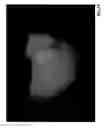 Fig. 20 - ORGAN REGENERATION METHOD UTILIZING BLASTOCYST COMPLEMENTATION