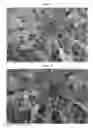 Fig. 04 - Weed control and fertilizer