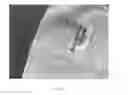 Fig. 09 - SWADDLING DEVICE