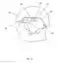 Fig. 02 - Hinged attachment of headgear to a helmet