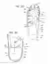 Fig. 79 - Custom Article of Footwear and Method of Making the Same