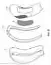 Fig. 06 - ATHLETIC GEAR OR OTHER WEARABLE ARTICLES COMPRISING AN EXPANDABLE USER-ENGAGING STRUCTURE