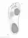 Fig. 02 - REUSABLE CUSTOM INSOLES
