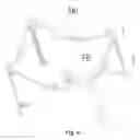 Fig. 05 - Travel bed