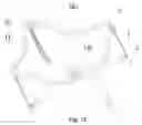 Fig. 10 - Travel bed