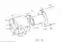 Fig. 04 - Removable tip endoscope
