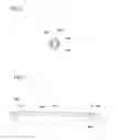 Fig. 06 - AUDITORY CANAL CLEANING TOOL AND AUDITORY CANAL OBSERVING TOOL