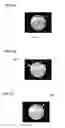 Fig. 13 - AUDITORY CANAL CLEANING TOOL AND AUDITORY CANAL OBSERVING TOOL