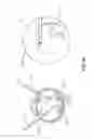 Fig. 05 - Visualization system for ophthalmic surgery