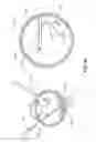 Fig. 09 - Visualization system for ophthalmic surgery