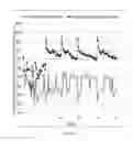 Fig. 11 - Fast absolute-reflectance method for the determination of tear film lipid layer thickness