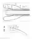 Fig. 08 - Treatment of appendage openings