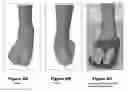 Fig. 07 - System and method for identifying physical properties of feet