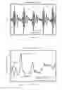 Fig. 04 - Wrist worn accelerometer for pulse transit time (PTT) measurements of blood pressure