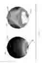 Fig. 07 - System for diagnosing mental disorders using neurometrics
