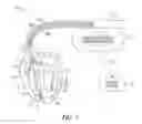 Fig. 02 - Detection of worsening heart failure