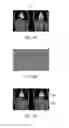 Fig. 05 - Method for segmenting small features in an image volume