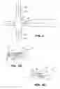Fig. 03 - Method and apparatus for accelerated disintegration of blood clot