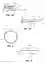 Fig. 04 - Method and apparatus for accelerated disintegration of blood clot