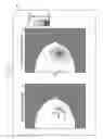 Fig. 11 - Hardness deriving device, medical imaging system, hardness deriving method and hardness deriving program storage medium