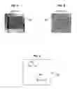 Fig. 04 - Signal processing for ultrasound imaging systems