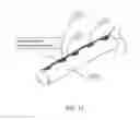 Fig. 14 - SHEATH-DILATOR SYSTEM AND USES THEREOF